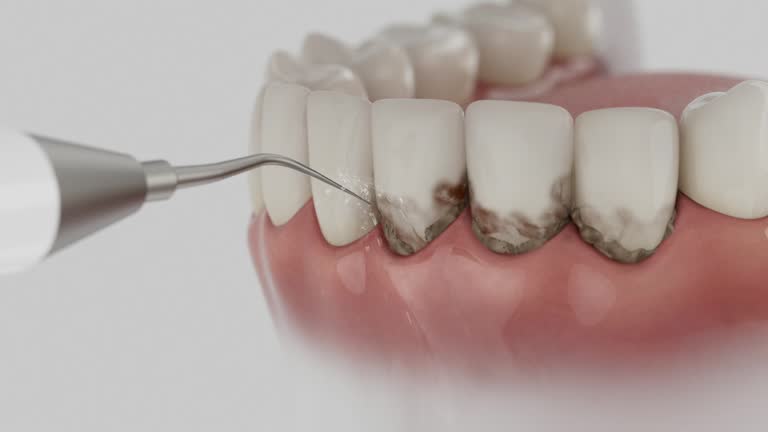 Trusted Teeth Cleaning And Checkup service in Nichols Hills, OK - Dentist Open Now